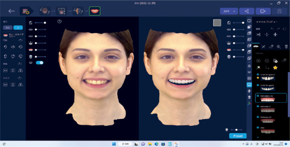RAYFace 画像合成イメージ
